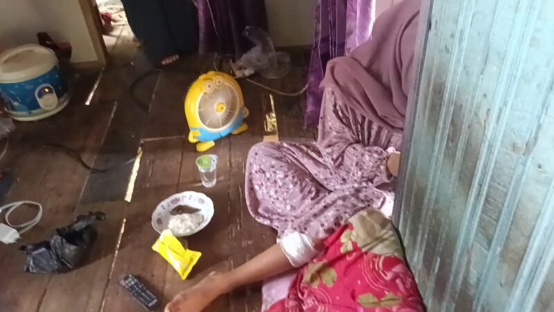 Salah satu warga yang mengalami penyerangan kera liar